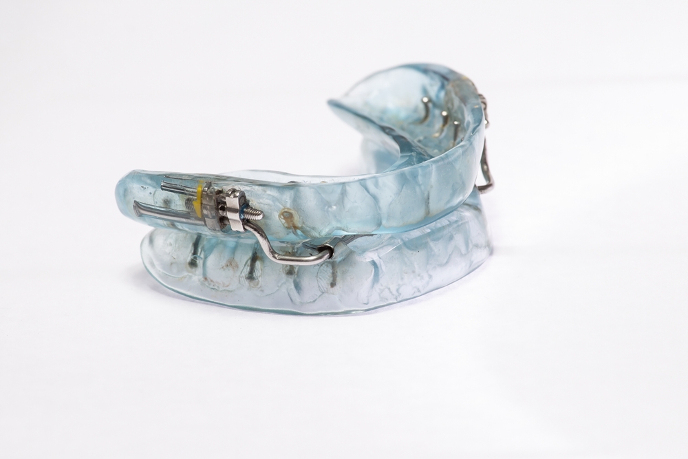 Mouth Guards for Sleep Apnea: An Overview